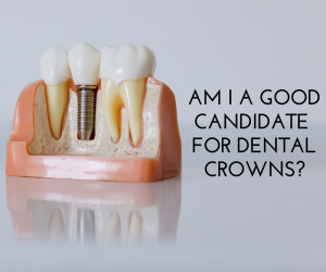 Am I a Good Candidate for Dental Crowns?